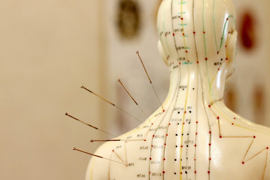 Acupuncture Chart and Meanings 2 1024x683 1 - Click42